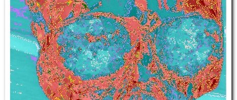 Another Lens: Crystal Skull Photo Analysis (Article by Julia Lincoln with Steven & Evan Strong)